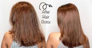 Advantages of Hair Botox Procedure